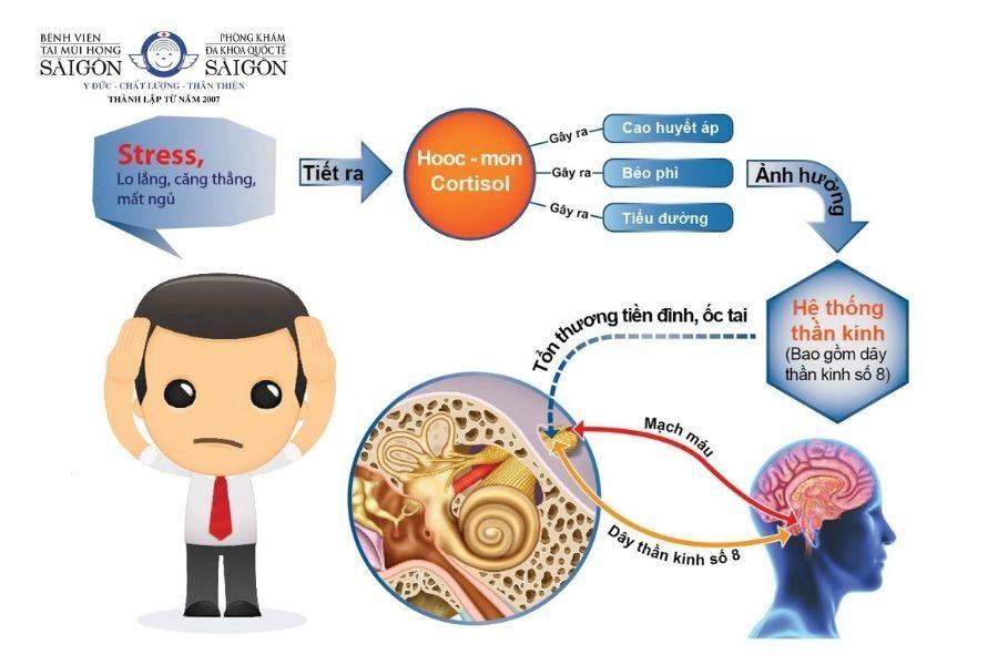 Gợi ý những cách chữa bệnh rối loạn tiền đình và cách phòng ngừa