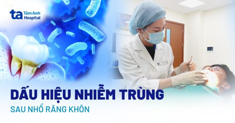 12 dấu hiệu nhiễm trùng sau khi nhổ răng khôn và cách xử lý