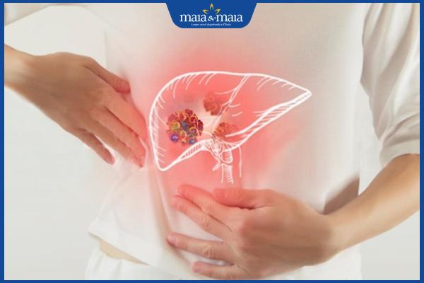 Mụn mọc ở trán gần chân tóc: Nguyên nhân và cách điều trị 